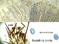 Scutellinia crinita-amf1415-2